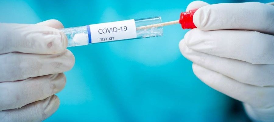 Advances in COVID-19 Testing
